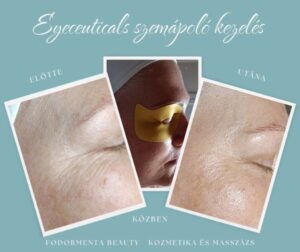 Eyeceuticals szemápoló kezelés (1)